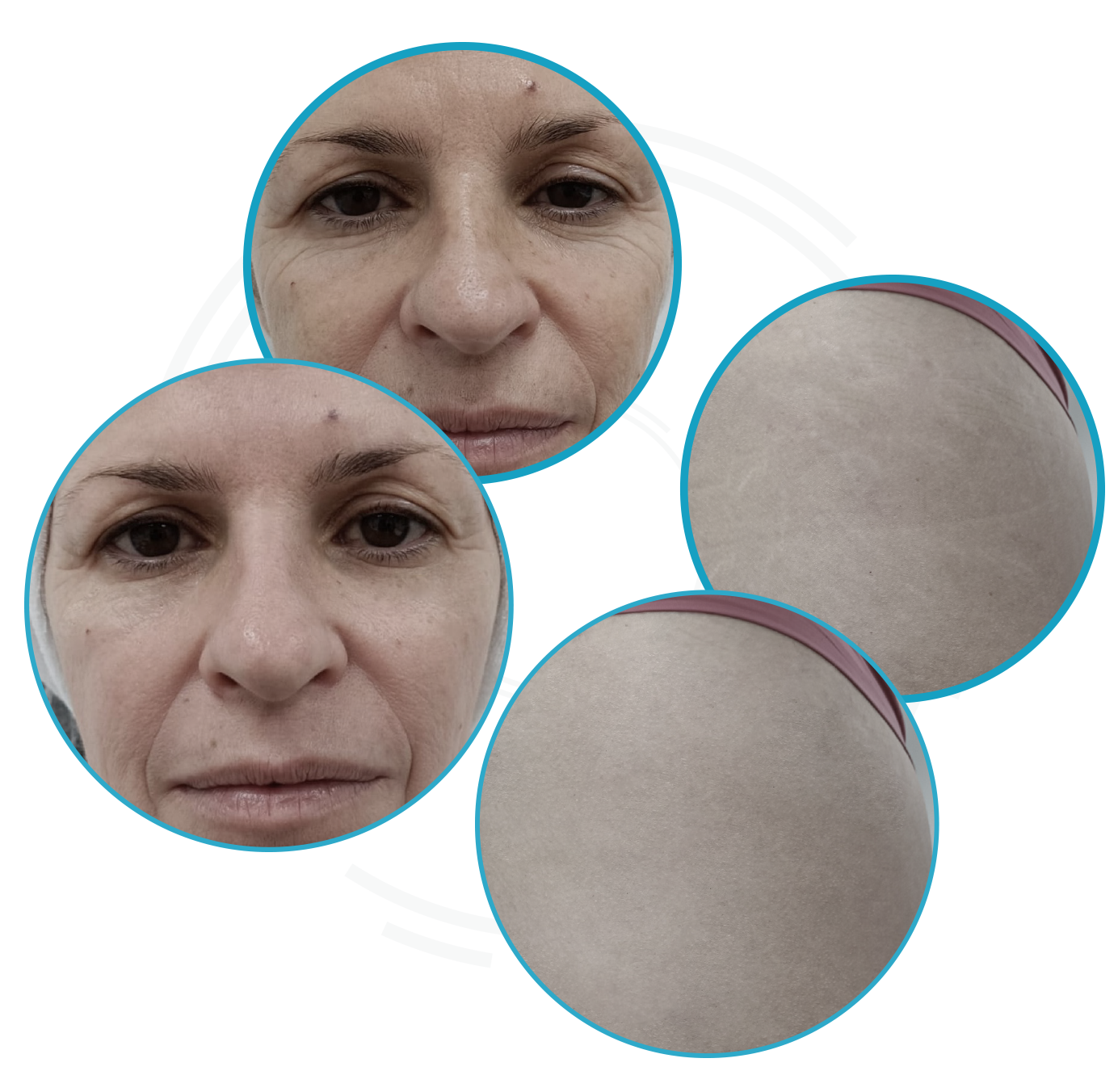 antes_despues-1
